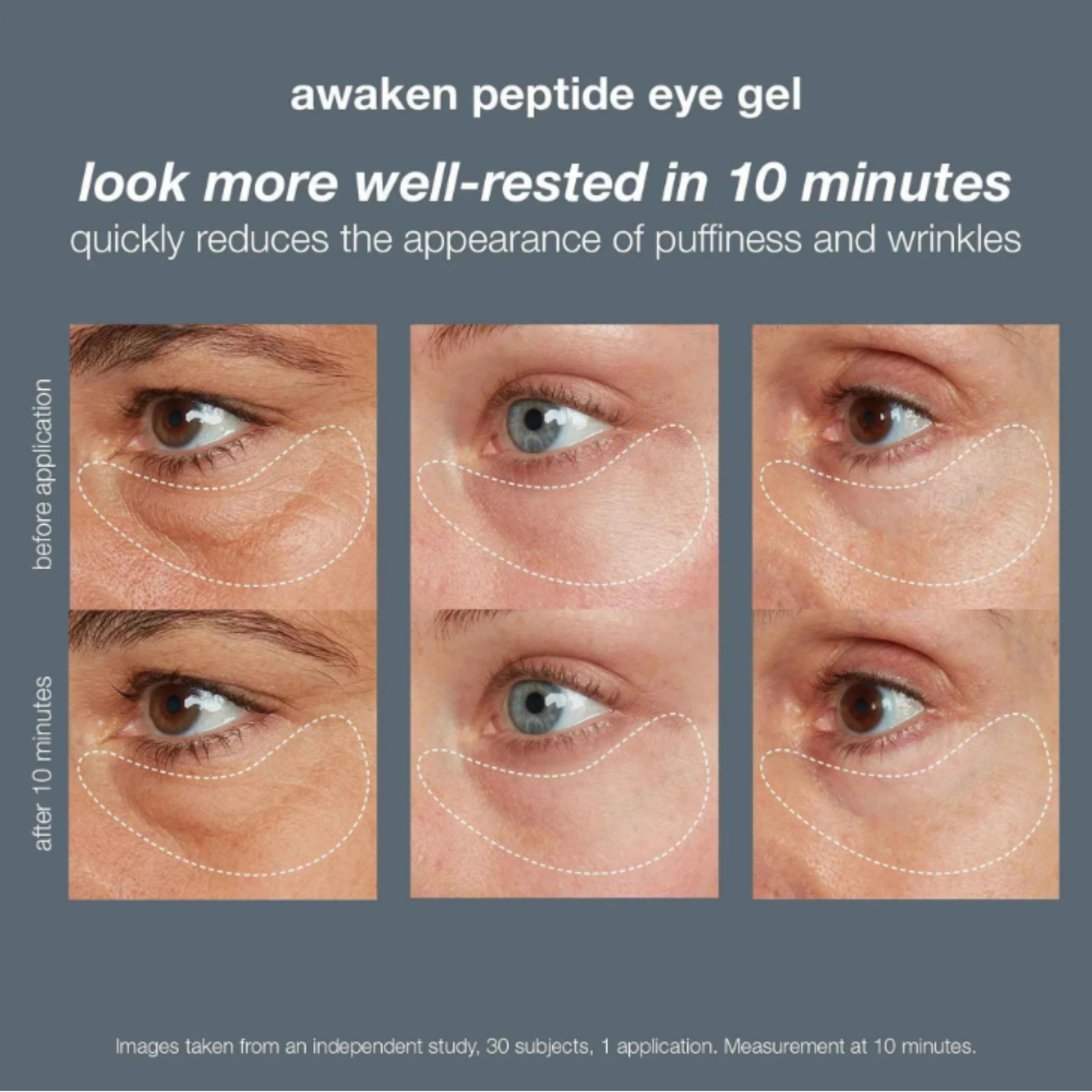 Awaken Peptide Eye Gel 15ml