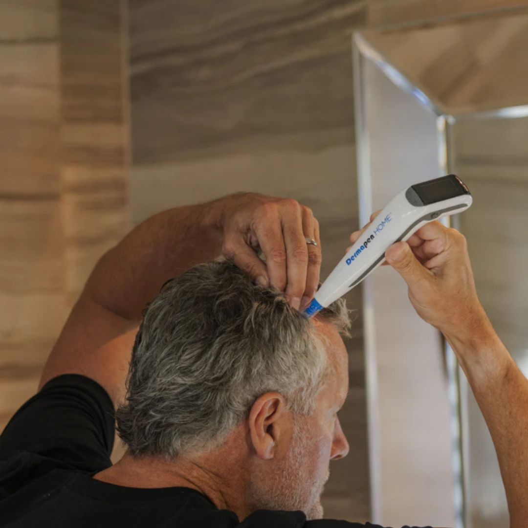 Exo-Grow Dermapen HOME